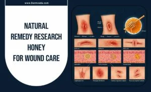 Natural Remedy Research: Honey For Wound Care