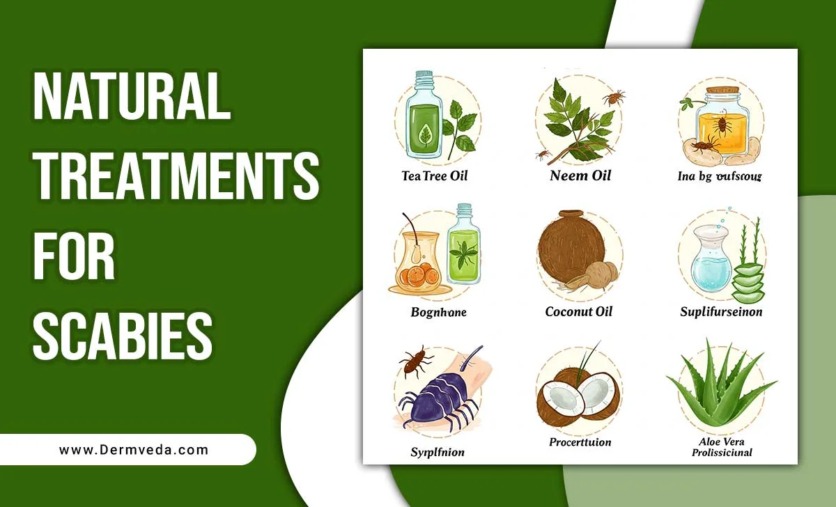 Natural Treatments For Scabies